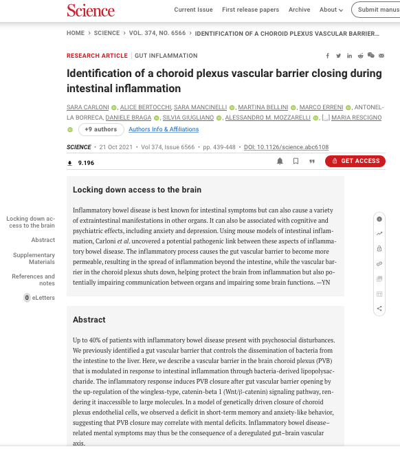 Identification of a choroid plexus vascular barrier closing during intestinal inflammation
